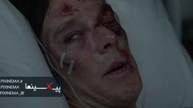 سکانس از کار افتادن دستان استیون در فیلم دکتر استرنج (Doctor Strange, 2016)